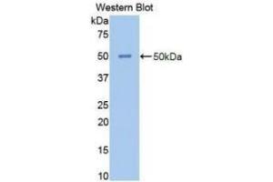 Detection of Recombinant NSE, Human using Polyclonal Antibody to Enolase, Neuron Specific (NSE) (ENO2/NSE anticorps  (AA 1-434))