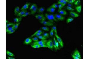 Immunofluorescent analysis of HepG2 cells using ABIN7153335 at dilution of 1:100 and Alexa Fluor 488-congugated AffiniPure Goat Anti-Rabbit IgG(H+L)