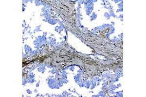 IHC analysis of Lumican using anti-Lumican antibody (ABIN6719339).