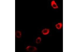 Immunofluorescent analysis of Neuroglobin staining in U2OS cells.