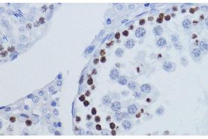 Immunohistochemistry of paraffin-embedded Rat testis using TriMethyl-Histone H3-K9 Polyclonal Antibody at dilution of 1:200 (40x lens). (Histone 3 anticorps  (3meLys9))