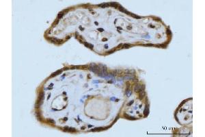 IHC analysis of SCP3/SYCP3 using anti-SCP3/SYCP3 antibody (ABIN7602415). (SYCP3 anticorps  (AA 75-236))