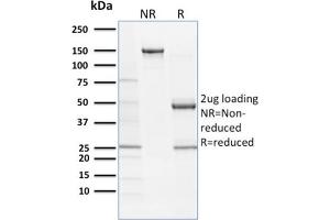 SDS-PAGE Analysis Purified SOX9 Mouse Monoclonal Antibody (SOX9/2387).