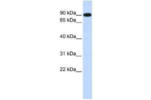 Western Blotting (WB) image for anti-Zinc Finger, X-Linked, Duplicated A (ZXDA) antibody (ABIN2458346) (ZXDA anticorps)
