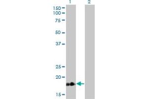 Western Blot analysis of TNNC1 expression in transfected 293T cell line by TNNC1 monoclonal antibody (M01), clone 1F8-A9.