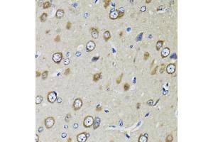 Immunohistochemistry of paraffin-embedded rat brain using RPS10 antibody (ABIN5973486) at dilution of 1/100 (40x lens). (RPS10 anticorps)