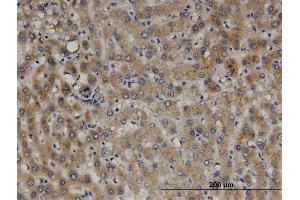 Immunoperoxidase of monoclonal antibody to PEX11B on formalin-fixed paraffin-embedded human liver.