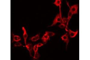ABIN6279255 staining A549 by IF/ICC.