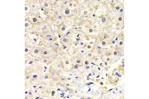 Immunohistochemistry of paraffin-embedded human liver injury using FKBP4 Antibody (ABIN5973289) at dilution of 1/200 (40x lens). (FKBP4 anticorps)