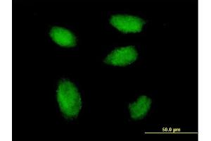 Immunofluorescence of monoclonal antibody to RSF1 on HeLa cell.