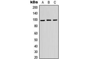 Western blot analysis of ATP6V0A2 expression in HEK293T (A), Raw264. (ATP6V0A2 anticorps  (Center))