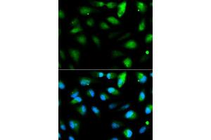 Immunofluorescence analysis of HeLa cell using F11R antibody. (F11R anticorps  (AA 30-238))