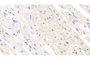 Detection of FECH in Human Cardiac Muscle Tissue using Polyclonal Antibody to Ferrochelatase (FECH) (FECH anticorps  (AA 55-423))