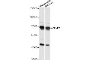 Western blot analysis of extracts of various cell lines, using CPNE6 antibody (ABIN6291377) at 1:3000 dilution. (CPNE6 anticorps)