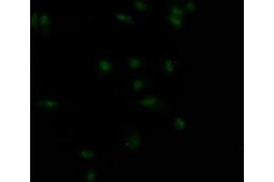 Immunofluorescence staining of MCF7 Cells with ABIN7127575 at 1:50, counter-stained with DAPI. (Recombinant Insulin Receptor anticorps)