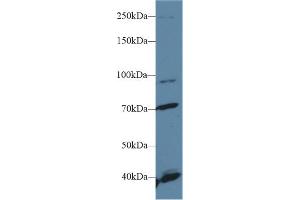 Western Blot; Sample: Human Hela cell lysate; Primary Ab: 1µg/ml Rabbit Anti-Human FGFR2 Antibody Second Ab: 0. (FGFR2 anticorps  (AA 157-377))
