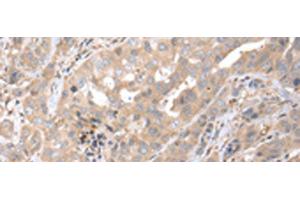 anti-Pro-Platelet Basic Protein (Chemokine (C-X-C Motif) Ligand 7) (PPBP) antibody