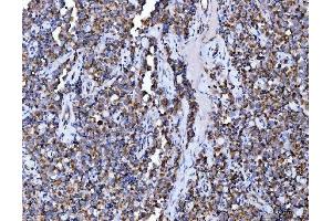 IHC analysis of Aconitase 2 using anti-Aconitase 2 antibody (ABIN7602770). (ACO2 anticorps  (C-Term))