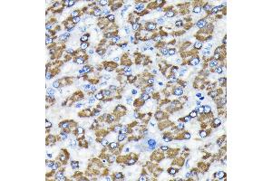 Immunohistochemistry of paraffin-embedded human liver using Smad3 Rabbit mAb (ABIN7270349) at dilution of 1:100 (40x lens).