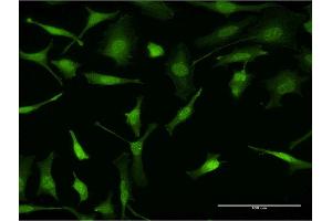 Immunofluorescence of monoclonal antibody to PURA on HeLa cell. (PURA anticorps  (AA 183-292))