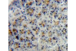 IHC-P analysis of adrenal tissue, with DAB staining. (IGFBP3 anticorps  (AA 137-274))