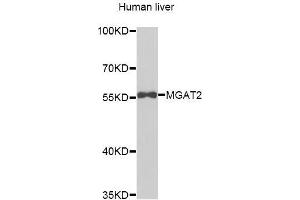 Western blot analysis of extracts of Human liver cells, using MGAT2 antibody.