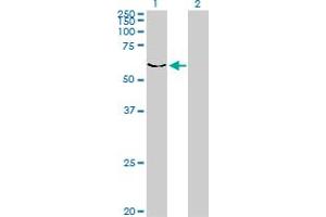 Western Blot analysis of DYRK2 expression in transfected 293T cell line by DYRK2 monoclonal antibody (M01), clone 3G5. (DYRK2 anticorps  (AA 1-100))