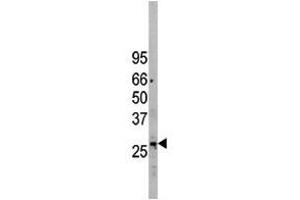 Image no. 1 for anti-Eukaryotic Translation Initiation Factor 2B, Subunit 3 Gamma, 58kDa (EIF2B3) (C-Term) antibody (ABIN357251)
