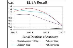 Black line: Control Antigen (100 ng), Purple line: Antigen(10 ng), Blue line: Antigen (50 ng), Red line: Antigen (100 ng), (EIF2A anticorps  (AA 448-576))