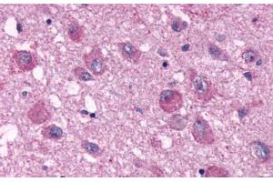 Anti-PPYR1 antibody  ABIN1049234 IHC staining of human brain. (NPY4R anticorps  (Extracellular Domain))