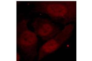 Image no. 2 for anti-Histone Deacetylase 2 (HDAC2) (pSer394) antibody (ABIN319237) (HDAC2 anticorps  (pSer394))