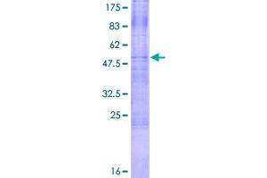 Image no. 1 for Tumor Necrosis Factor Receptor Superfamily, Member 10c (TNFRSF10C) (AA 1-259) protein (GST tag) (ABIN1323146)