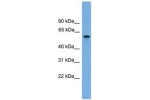 Image no. 1 for anti-MTOR associated protein, eak-7 homolog (MEAK7) (C-Term) antibody (ABIN6746516) (KIAA1609 anticorps  (C-Term))
