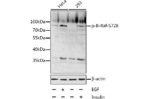 Western blot analysis of extracts of various cell lines, using Phospho-B-Raf-S728 antibody (ABIN6135192, ABIN6136028, ABIN6136029 and ABIN6225598).