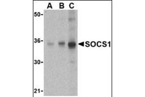 Western blot analysis of SOCS1 in Human spleen cell lysate with this product at (A) 1, (B) 2 and (C) 4 μg/ml. (SOCS1 anticorps  (N-Term))