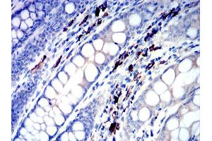 Immunohistochemical analysis of paraffin-embedded colon tissues using IGLC2 mouse mAb with DAB staining. (IGLC2 anticorps  (AA 1-106))