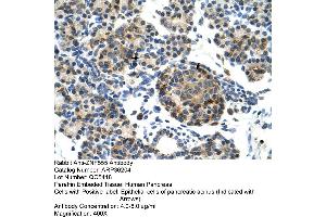 Human Pancreas (ZNF555 anticorps  (N-Term))