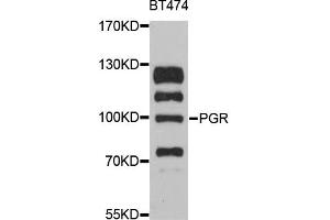 Western blot analysis of extracts of BT-474 cells, using PGR antibody. (Progesterone Receptor anticorps)