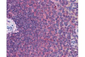 Anti-MDA5 antibody IHC of human spleen. (IFIH1 anticorps  (AA 612-661))