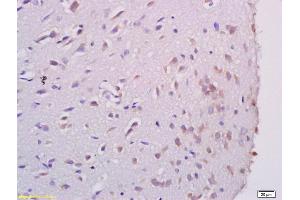 Formalin-fixed and paraffin embedded rat brain labeled with Anti AATF Polyclonal Antibody, Unconjugated (ABIN673689) at 1:200 followed by conjugation to the secondary antibody and DAB staining