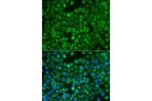 Immunofluorescence analysis of A549 cell using MTMR4 antibody. (MTMR4 anticorps)