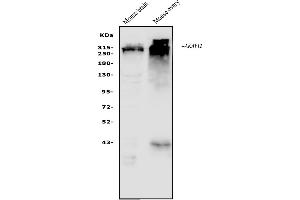 Western blot analysis of AKAP12 using anti-AKAP12 antibody (ABIN7601563). (AKAP12 anticorps  (AA 387-1620))