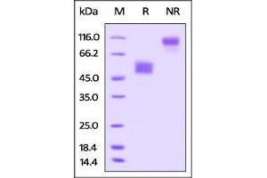 Rat TIGIT, Fc Tag on SDS-PAGE under reducing (R) and no-reducing (NR) conditions.