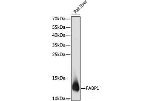 Western blot analysis of extracts of Rat liver using FABP1 Polyclonal Antibody at dilution of 1:1000. (FABP1 anticorps)
