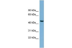 Human OVCAR-3; WB Suggested Anti-ALPPL2 Antibody Titration: 0. (ALPPL2 anticorps  (Middle Region))
