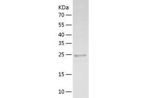 Western Blotting (WB) image for Fibroblast Growth Factor Binding Protein 1 (FGFBP1) (AA 24-234) protein (His-IF2DI Tag) (ABIN7122954)