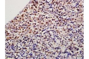 Formalin-fixed and paraffin embedded mouse fetal liver labeled with Rabbit Anti-TXNDC9 Polyclonal Antibody, Unconjugated  at 1:200 followed by conjugation to the secondary antibody and DAB staining