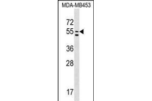 PTDSS1 Antibody (C-term) (ABIN1537254 and ABIN2848773) western blot analysis in MDA-M cell line lysates (35 μg/lane). (PTDSS1 anticorps  (C-Term))