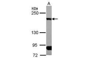 Image no. 1 for anti-CAP-GLY Domain Containing Linker Protein 1 (CLIP1) (N-Term) antibody (ABIN1494006) (CLIP1 anticorps  (N-Term))
