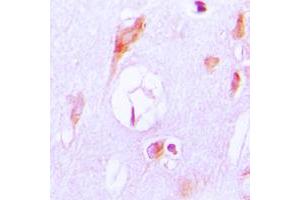 Immunohistochemical analysis of Cytochrome P450 27A1 staining in human brain formalin fixed paraffin embedded tissue section.